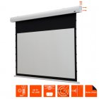 Celexon HomeCinema Pantalla de Proyección Eléctrica de Tensión 80" 180x102cm