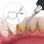 Ailoria Deplaqued Limpiador Dental Sónico Black