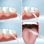 InnovaGoods Denter Irrigador Dental Portátil Recargable