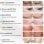 Lalano'S Cosmetics BeautyMask Anti-Aging LED-Gesichtsmaske