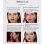 Lalano'S Cosmetics Eye Catcher Tratamiento de microcorriente, Radiofrecuencia y Fototerapia Antiedad