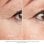 Dispositivo Facial Silk'n FaceTite Mini Blanco Radiofrecuencia RF LED Antiedad Integrado