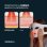 LED-Maske Wellbeinn Redinn Mask Rot- und Infrarotlicht