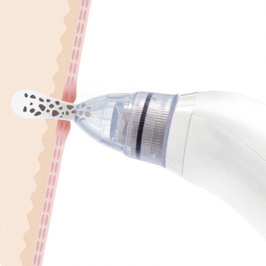 InnovaGoods Limpiador Facial Eléctrico para Puntos Negros