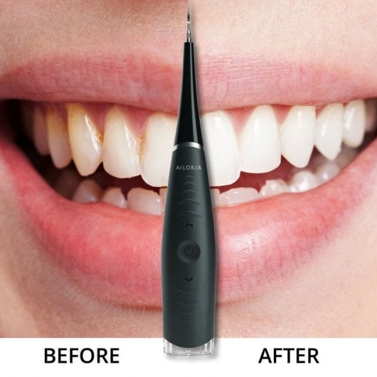 Ailoria Deplaqued Limpiador Dental Sónico Black