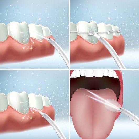 Irrigatore dentale portatile ricaricabile Denter InnovaGoods