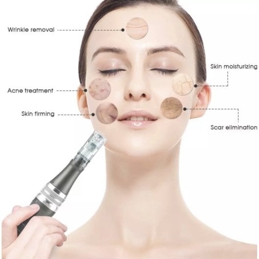 Penna ad ago per microneedling Lalano's Cosmetics