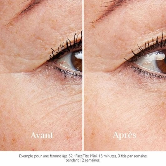 Dispositivo Facial Silk'n FaceTite Mini Blanco Radiofrecuencia RF LED Antiedad Integrado