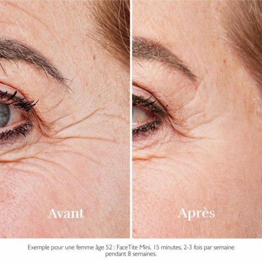 Dispositivo Facial Silk'n FaceTite Mini Blanco Radiofrecuencia RF LED Antiedad Integrado