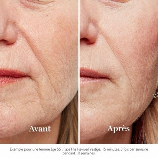 Dispositivo Reafirmante Facial Beurer FC100 HT Home Tightening sem fio, tecnologia RF e LED