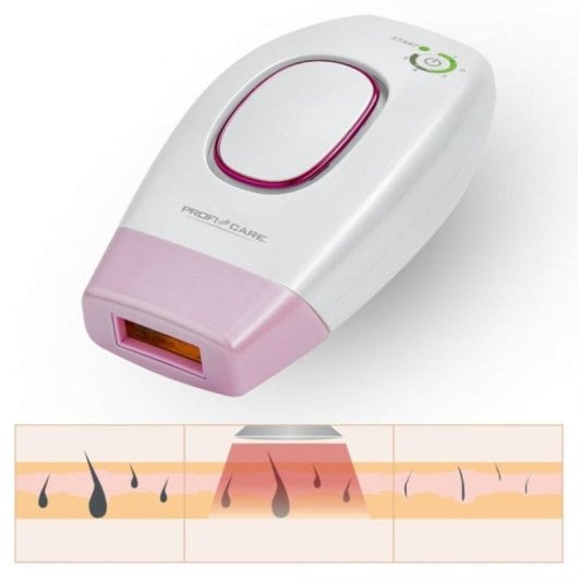 Épilateur IPL ProfiCare PC-IPL 3024 Sans Fil 4 J/cm² Rose Blanc