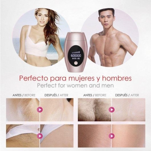 IPL Haarentfernung Dam Electronics A110 8 Stufen 600000 Lichtimpulse