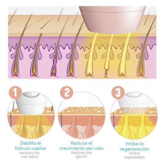 Depiladora IPL de Luz Pulsada Dam Electronics A109 Lámpara de Cuarzo 600000 Pulsos 5 Niveles Full Body