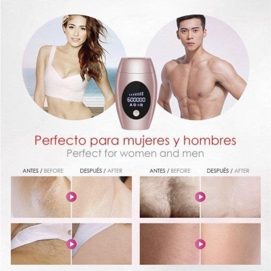 Épilateur Lumière Pulsée Dam Electronics A109 5 Niveaux 600000 Pulsations