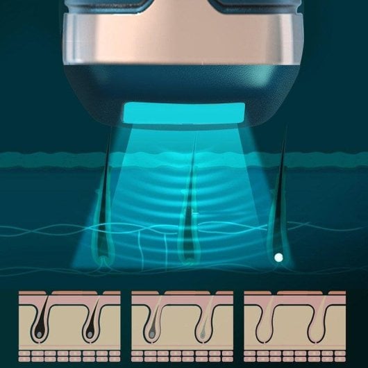 Depiladora IPL Dam Electronics T58 Luz Pulsada, Base Carga y Desinfección UV