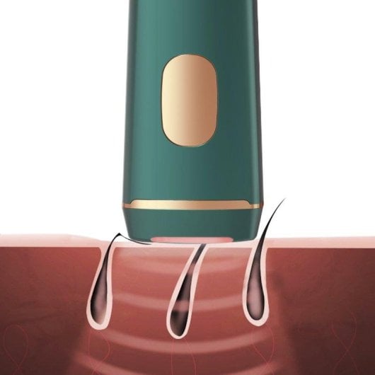 Depiladora IPL Dam Electronics T22 de luz pulsada 36W 990000 flashes LED