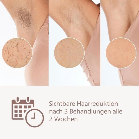 Depiladora de luz pulsada Philips Lumea Prestige BRI953/02 inalámbrica SkinAI