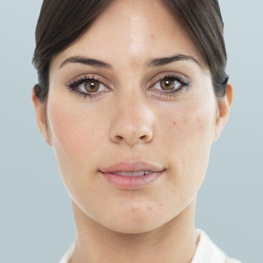 Limpiador Facial Elétrico InnovaGoods Moispa Pore·Off Pack ABS Branco Rosa