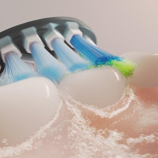 Cabezal Cepillo de Dientes Philips Sonicare Premium Plaque Defence Pack 5 Unidades Negro Medio 62000 Vibraciones