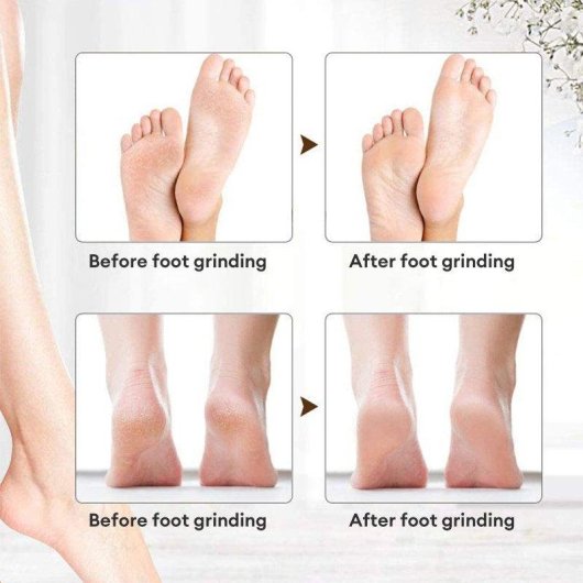 Exfoliante de pies Paxa-bz-x2l Impermeable Portátil Fácil de Operar