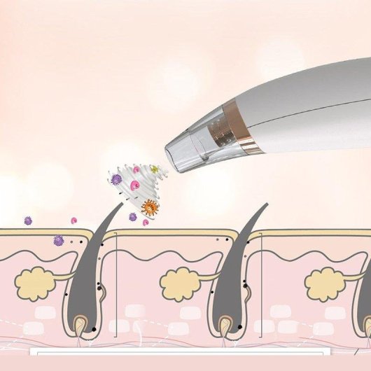 Extractor de puntos negros Dam Electronics X4 3 modos para todo tipo de piel