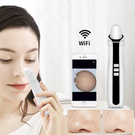 Dispositivo de limpieza facial Dam Electronics Ajustable 3 Niveles Gran Potencia de Succión