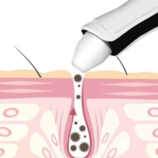 Dispositivo de limpieza facial Dam Electronics Ajustable 3 Niveles Gran Potencia de Succión