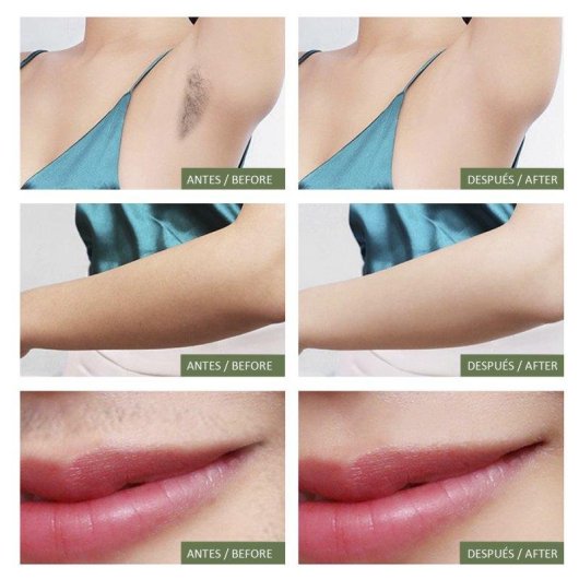 Depiladora Luz Pulsada IPL Dam Electronics T66s 5 Niveles Pantalla LED Protección Automática