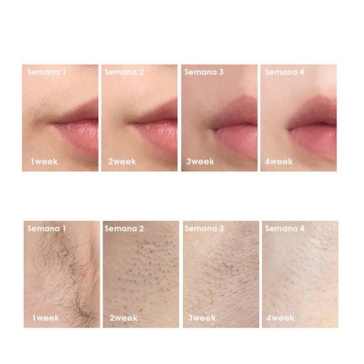 Depiladora Luz Pulsada IPL Dam Electronics TS6 5 Ajustes Pantalla LED Protección Apagones