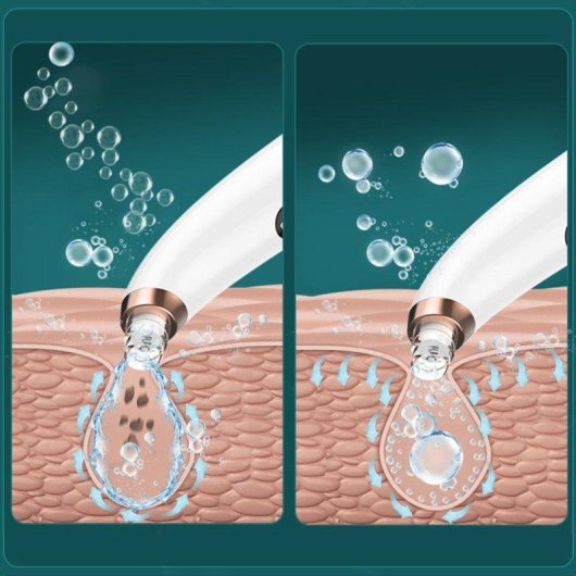 Extractor de puntos negros Dam Electronics X13 con 3 modos y circulación de agua