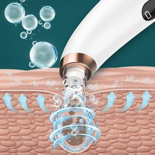 Extractor de puntos negros Dam Electronics X13 con 3 modos y circulación de agua