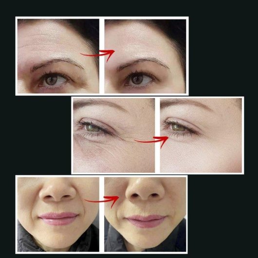 Instrumento de belleza facial Dam Electronics EMS LED 3 colores WAV VR