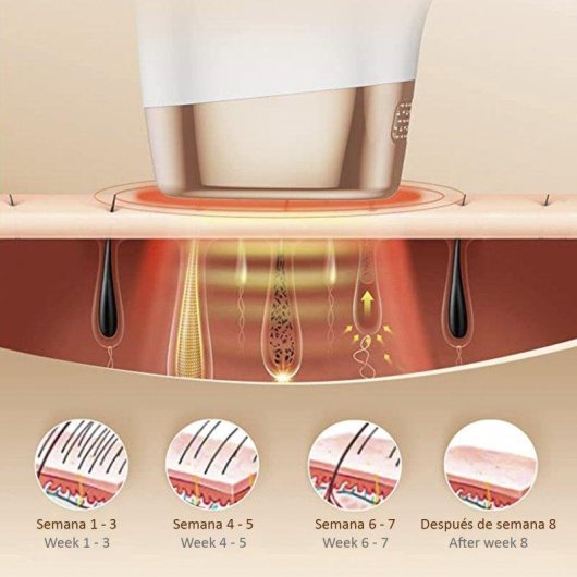 Depiladora Luz Pulsada IPL Dam Electronics TS8 5 Niveles Pantalla LED