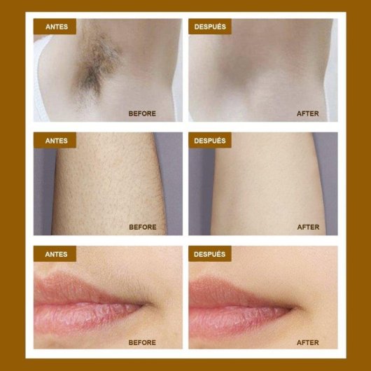 Depiladora Luz Pulsada IPL Dam Electronics TS8 5 Niveles Pantalla LED