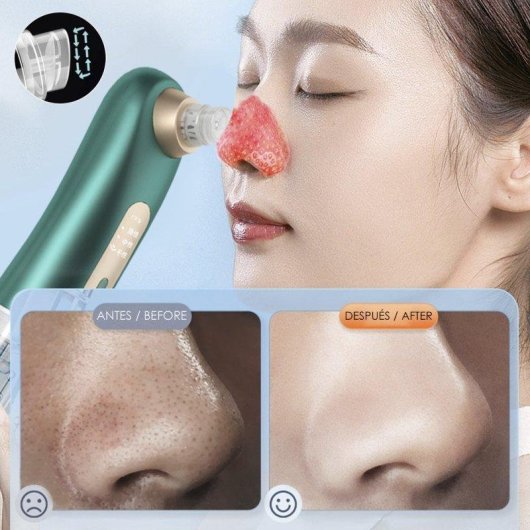 Dispositivo de limpieza facial Dam Electronics 3 modos, depósito doble de agua, 6 cabezales