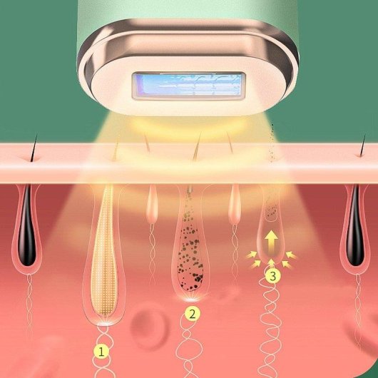 Depiladora Luz Pulsada IPL Dam Electronics T61 5 Niveles Pantalla LED