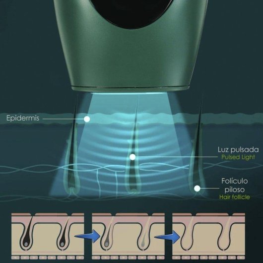 Epilatore Luce Pulsata Dam Electronics 8 Livelli 900000 Flash Display LED