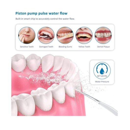 Irrigadores Dentais Klack Water Flosser Tecnologia Sem Fios Reservatório 300 ml IPX7