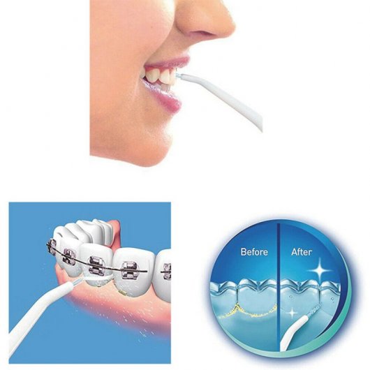 Silvano Irrigador Bucal con Sistema de Propulsión